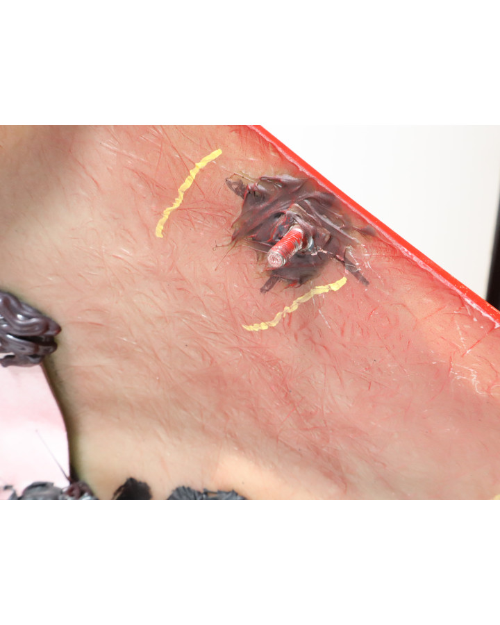 Bellier B8, stötfångare fram komplett